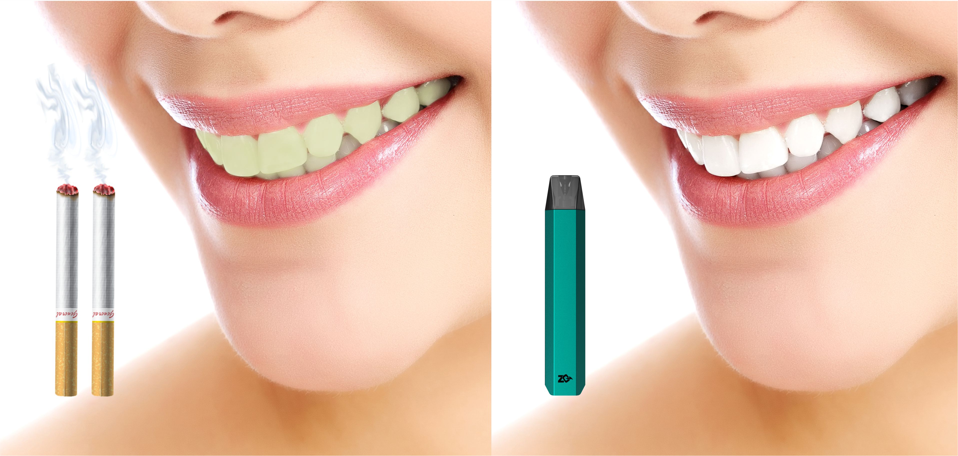 Does Vaping Stain Your Teeth?  